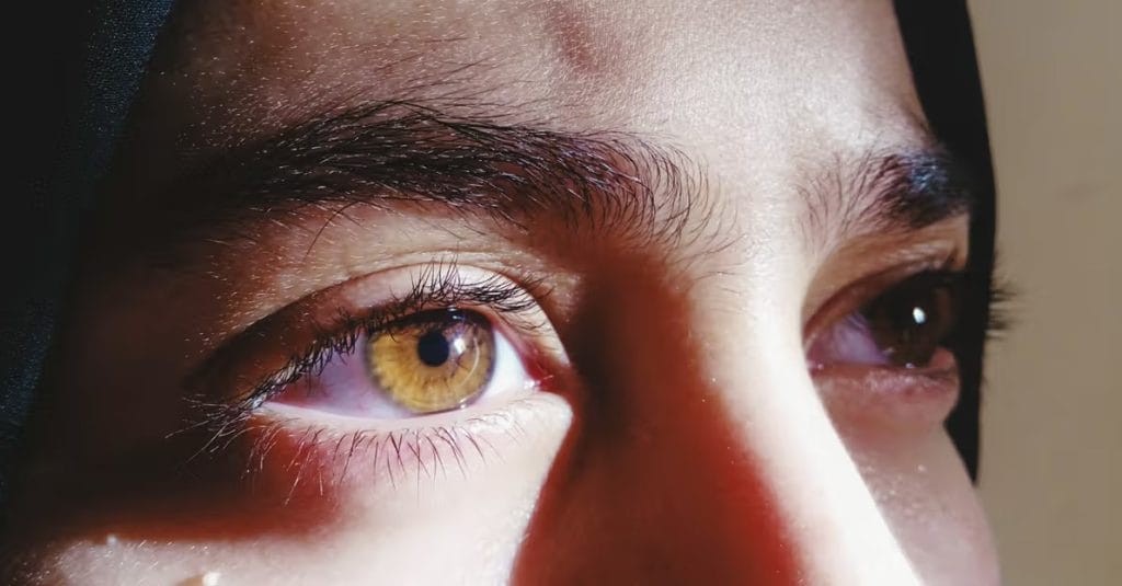 معاینات پیش از جراحی حذف عینک