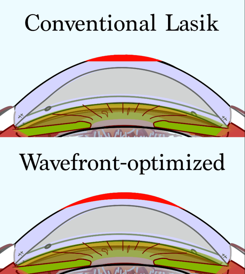 Laser
Biophysics بیوفیزیک لیزر