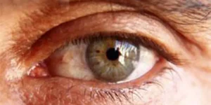 لنزهای داخل چشمی، تصحیح کننده پیرچشمی