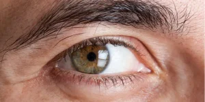 آنژیوگرافی شبکیه