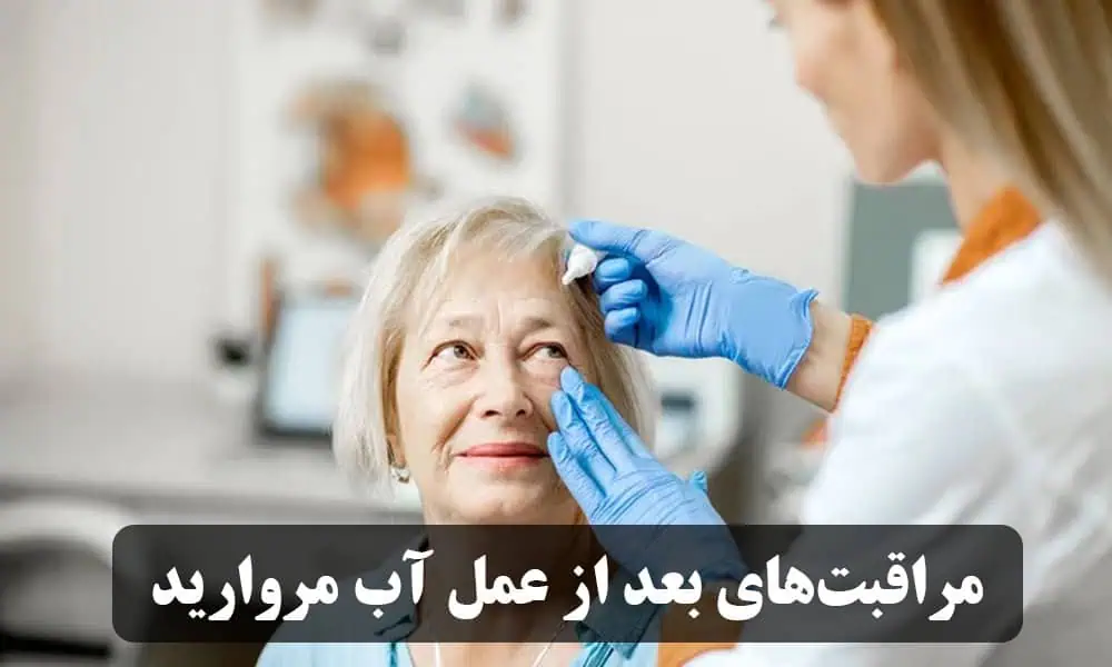 مراقبتهای بعد از عمل آب مروارید