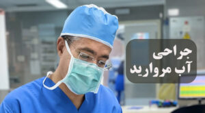 عمل آب مروارید 