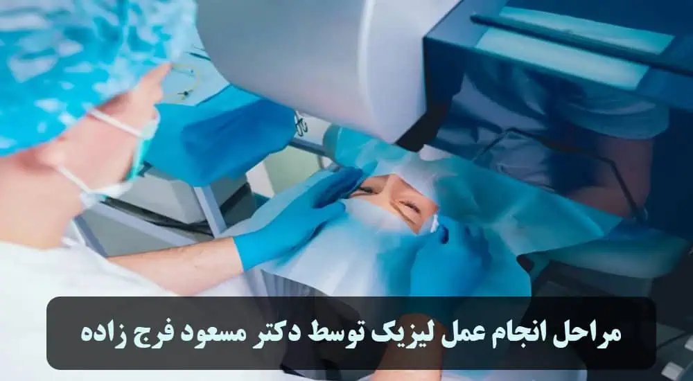 مراحل انجام عمل لیزیک توسط دکتر مسعود فرج زاده 